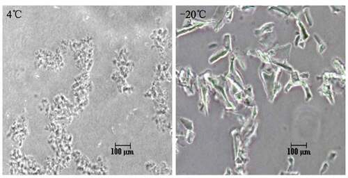Figure 2. Different profile detected by Phase contrast microscopy. (A) The morphology of non-frozen samples showed fine-grain structure. (B) Freeze-damaged samples showed large conglomerates of massed precipitates with heterogeneous structures.
