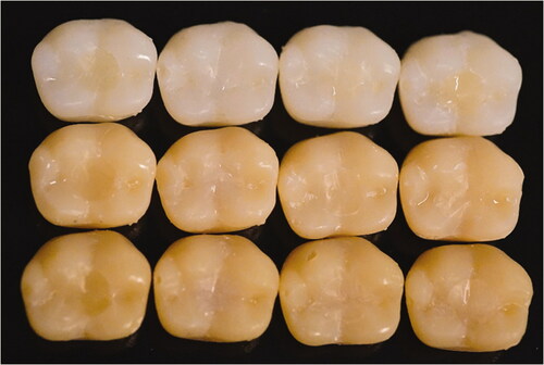 Figure 2. Representative images of different colored plastic crowns with composite restorations for visual color matching analysis. From left to right: G1A, G7A, Omnichroma, Filtek Supreme (shade A3). Shades from up to down: A1, A3, A4.