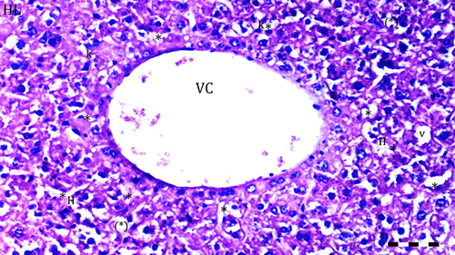 Figure 6 Representative light microscopy of hepatic tissue from DIR-S-FC60 group. Scale bar 50 µm, H&Ex100.