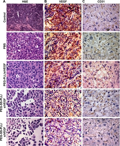 Figure 9 Tumor growth and expression of VEGF and CD31 by immunohistochemistry.Notes: Tumor-bearing mice were killed 28 days after initial injection, then tumor tissues were collected and processed for paraffin-embedded sections and immunohistochemical staining (n=5). Brown staining in the tissue sections shows positive expression of VEGF or CD31. Images 400×. (A) H&E staining shows inhibition of tumor growth after intravenous tail injection of PEG-SS-PLL/siVEGF complex compared to control, PBS, PEG-SS-PLL/siLuc, and PEG-PLL/siVEGF groups; (B) VEGF staining shows levels of different types of VEGF-protein expression; (C) CD31 staining shows levels of CD31-protein expression, in contrast to control, PBS, PEG-SS-PLL/siLuc, and PEG-PLL/siVEGF groups.Abbreviations: H&E, hematoxylin and eosin; PEG-SS-PLL, polyethylene glycol–poly(ε-benzyloxycarbonyl-l-lysine); siVEGF, small interfering VEGF RNA; mRNA, messenger RNA; PCR, polymerase chain reaction; ELISA, enzyme-linked immunosorbent assay; PBS, phosphate-buffered saline.