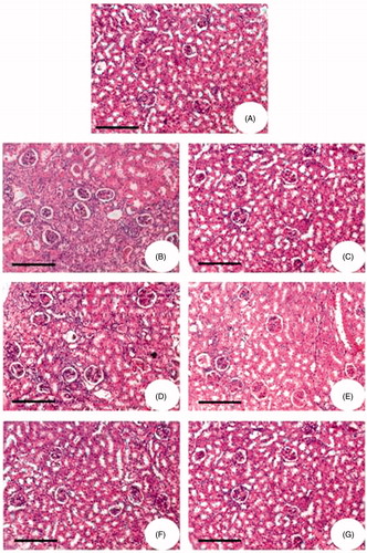 Figure 7. Hematoxylin and eosin-stained kidney sections of Wistar rats. (A) Physiological saline-injected rat (group I). (B) Animals administered with glycerol alone (group II). (C) The animals were administered with glycerol simultaneously treated with 5 mg/kg body weight FA. (D) The animals were administered with glycerol simultaneously treated with 10 mg/kg body weight FA. (E) The animals were administered with glycerol simultaneously treated with 15 mg/kg body weight FA. (F) The animals were administered with glycerol simultaneously treated with 20 mg/kg body weight FA. (G) The animals were administered with glycerol simultaneously treated with 25 mg/kg body weight FA.