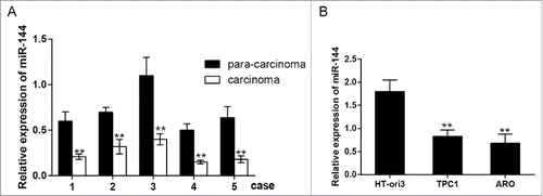 Figure 1. MiR-144 was down-regulated in ATC cells and tissues. A. MiR-144 low expressed in carcinoma tissues uncovered by QRT-PCR. **P < 0.01 compared with the normal tissues. B. MiR-144 low expressed in cancer cell lines ARO and TPC1 uncovered by QRT-PCR. **P < 0.01 compared with the HT-ori3 group. ATC: anaplastic thyroid carcinoma; number of carcinoma tissues = 5, number of para-carcinoma tissues = 5.