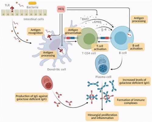 Figure 2. Potential mechanisms for hydroxychloroquine (HCQ) action in IgA nephropathy (IgAN). HCQ can interfere with immune activation at various cellular levels by inhibiting the innate and adaptive immune systems. In IgAN, mucosal Toll like receptor-9 (TLR-9) activation induces B-cell activating factor (BAFF) overexpression in dendritic cells, stimulates the generation of proliferation-inducing ligand (APRIL) and interleukin-6 (IL-6), which act concurrently to stimulate the production of galactose deficient IgA1. HCQ interferes with TLR9 ligand binding and TLR signaling (through lysosomal inhibition), which inhibits TLR-mediated cell activation and cytokine production. Moreover, in antigen presenting cells, such as dendritic cells and B cells, HCQ inhibits antigen processing and subsequent MHC class II presentation to T cells, preventing T cell activation, differentiation and expression of co-stimulatory molecules.