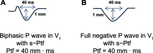 Figure 1 (A and B) Schematic illustration of how to calculate Ptf.