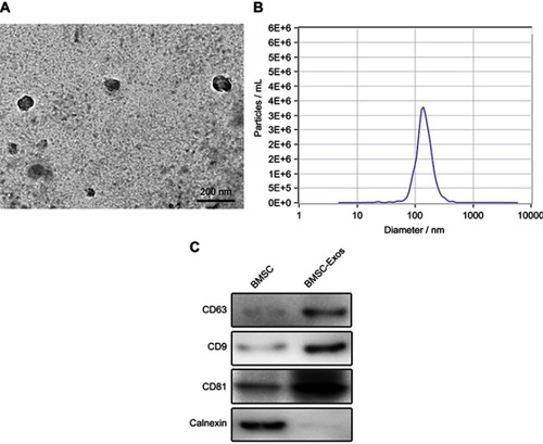 Figure 1 Characterization of BMSC-derived exosomes (BMSC-Exos). (A) Exosome morphology revealed by transmission electron microscopy (TEM). (B) Particle size distribution measured by nanoparticle tracking analysis (NTA). (C) Western blot analysis of specific exosome surface markers.