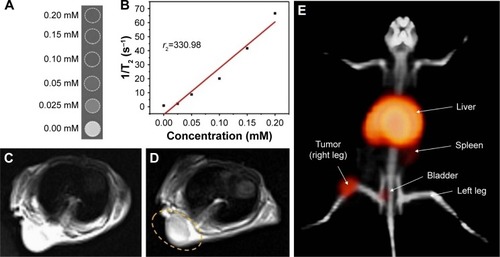 Figure 10 Phantom study, MRI, and PET/CT of DOTA–BN–TMC–MNPs and 68Ga–DOTA–BN–TMC–MNPs. (A) MRI phantom study of serially diluted aqueous solutions of 200 µM DOTA–BN–TMC–MNPs for Fe and (B) relaxation rate (1/T2) as a function of iron concentration. MR images of shoulder xenograft nude mouse (C) before and (D) after DOTA–BN–TMC–MNPs injection through the tail vein (1 hour) under the 3T magnetic field. Yellow circle demonstrates the uptake of NPs to the tumor. (E) PET/CT image of a nude mice bearing T-47D BC tumor in the right leg in the supine position following the injection of 3.7 MBq 68Ga–DOTA–BN–TMC–MNPs after 120 minutes.Abbreviations: 1/T2, relaxation rate; MR, magnetic resonance; MRI, MR imaging; PET, positron emission tomography; CT, computed tomography; DOTA, S-2-(4-isothiocyanatobenzyl)-1,4,7,10-tetraazacyclododecane tetraacetic acid; BN, bombesin; TMC, N,N,N-trimethyl chitosan; MNP, magnetic nanoparticle; 68Ga, gallium-68; NP, nanoparticle; BC, breast cancer.