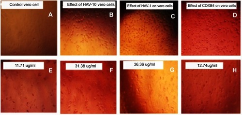 Figure 5 (A) Control Vero cell, (B) effect of HAV-10 virus on Vero cell, (C) effect of HSV-1 virus on Vero cell, (D) effect of COXB4 virus on Vero cell, (E) effect of Lampranthus coccineus hexane nano extract against HAV-10 virus (11.71 µg/mL), (F) effect of Malephora lutea hexane nano extract against HAV-10 virus (31.38 µg/mL), (G) effect of Lampranthus coccineus hexane nano extract against HSV-1 virus (36.36 µg/mL), (H) effect of Lampranthus coccineus hexane nano extract against COXB4 virus (12.74 µg/mL).