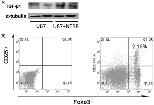 Figure 3. NTBR to promote malignant glioma cell immune escape. (A) Western blot to detect the expression of TGF-β in U87 after treated with endothelin B receptor; and (B) the expression of U87 after the addition of endothelin B receptor.
