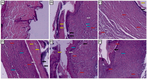 Figure 5. Photomicrographs of sections of hematoxylin and eosin-stained wound skin tissues. Microscopic image of wound skin of normal rat (A), vehicle control group (B), framycine sulfate ointment (1% w/w)-treated group (C), naringin ointment (1%, w/w)-treated group (D), naringin ointment (2%, w/w)-treated group (E); naringin ointment (4%, w/w)-treated group. Images (×100 magnification) are typical and are representative of each study group.