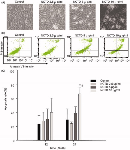 Figure 2. Effect of NCTD on the apoptosis of HMC cells. NCTD induced morphological changes of HMC cells (A). NCTD induced apoptosis of HMC cells (B).*p < .05, **p < .01 indicates a significant difference versus the control group, #p < .05, ##p < .01 indicates a significant difference versus the 12 h group (C).