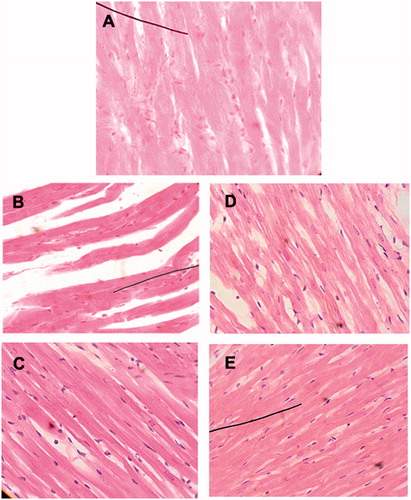 Figure 4. Histological examination via light microscopy (×400). (A) control heart; (B) electrolyzed heart (note the distorted appearance of the cardiomyocytes with wider intercellular spaces); (C) heart electrolyzed plus saffron (the cardiomyocytes have an appearance closer to normal and the spaces between the cells are significantly reduced); (D) heart perfused with doxorubicin (formation of edema and less adhesion between the cardiomyocytes); and (E) heart perfused with doxorubicin plus saffron (the general appearance of the cardiac tissue is similar to the control heart).