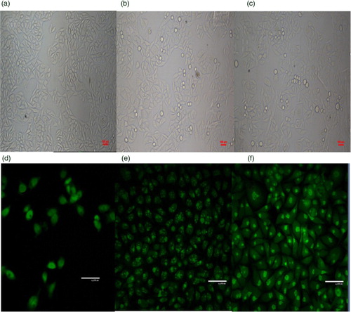 Fig. 2 Morphological changes of cells treated by LBP. a, b, c show images of SMMC-7721 cells observed by inverted microscope (500×), and d, e, f are images observed by laser scanning confocal microscope (500×); a and d are the control groups; b and e are cells treated with LBP-d (400 mg L−1) for 4 days; c and f are cells treated with LBP-e at 400 mg L−1 for 4 days.