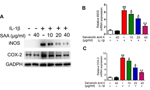 Figure 4 The expression of inflammation factors in IL-1β-induced chondrocytes including iNOS and COX-2 in human primary chondrocytes (tested by Western blot (A) and RT-qPCR (B, C)). Data are presented as the mean ± standard deviation (n=3). *p < 0.05 vs the control group; **p < 0.01 vs the control group; ##p < 0.01 vs the IL-1β group.