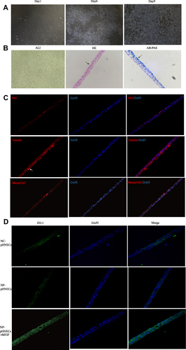 Figure 5 Identification of pHNECs and the effects of rhEGF. (A) Images of pHNECs identified with microscopy. (B) Images of pHNECs cultured in ALI (The arrow in HE shows the cilia structure; the arrow in AB-PAS shows the mucous cells). (C) Images of pHNECs cultured in ALI identified with immunofluorescence. (D) RhEGF up regulated the expression of ZO-1 in pHNECs from NP tissues. (Original magnification, ×400).