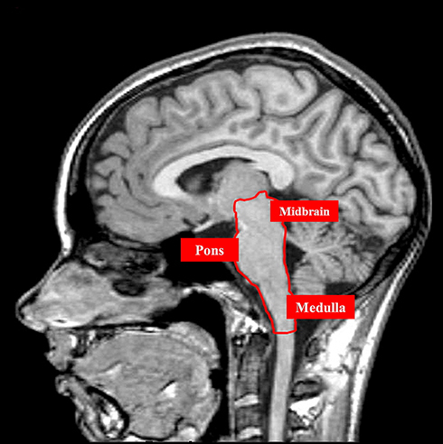 Figure 4 The figure illustrates an MRI image without contrast, highlighting, in a sagittal plane, the midbrain area, pons and medullary area. This anatomical area encloses the kernel of the respiratory network.