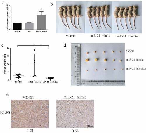 Figure 7. miR-21 promotes PCa tumor growth in xenograft mice.