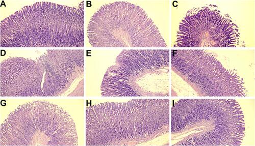 Figure 7 The microphotographs of stomach tissue after hematoxylin-eosin staining revealed that the studied compounds neither altered the normal stomach tissue architecture nor induced ulcerations. Indomethacin was used as a reference drug. Experimental groups: control group (A); carrageenan group (B); group receiving 10 mg/kg indomethacin (C–E); group receiving 10 mg/kg compound 10b (F); group receiving 20 mg/kg compound 10b (G); group receiving 10 mg/kg compound 13b (H); group receiving 20 mg/kg compound 13b (I); magnification 100×.