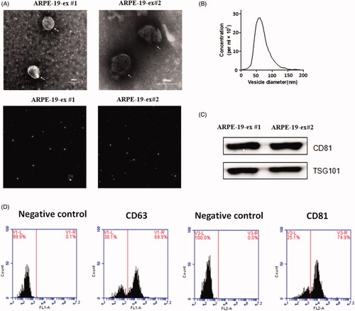 Figure 1. (A) Upper micrographs: particles derived from RPE appeared as specific spheroidal shape under electron microscopy. Bottom micrographs: the particles of scattering light were observed using the ZETASIZER Nano series-Nano-ZS instrument. When laser is projected on these samples, these white objects can refract the scattering light, indicating that the size of particles is uniform under dynamic light scattering. (B) Concentration and size distribution of the particles samples derived from RPEs by NTA. The diameters of extracted particles ranged between 40 and 100 nm. (C) Western blot assay was used to identify the biomarkers of these particles. The exosomes biomarkers CD81 and TSG101 were detected in these vesicles. (D) Flow cytometry analysis showed that surface proteins CD63 and CD81 were expressed in these vesicles (#1 and #2 represents two replicate samples derived from RPEs).