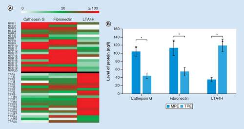 Figure 1. Three potential pleural effusion biomarkers for antidiastole of tuberculous pleural effusion and malignant pleural effusion. (A) Heat map of cathepsin, fibronectin and LTA4H levels in TPE and MPE samples. The heat map above the black line is the MPE group and the heat map under the black line is the TPE group. (B) The average levels of cathepsin, fibronectin and LTA4H expressed in TPE and MPE measured by proteomics analysis. The reported values are the mean ± SD.*p < 0.05.MPE: Malignant pleural effusion; SD: Standard deviation; TPE: Tuberculous pleural effusion.