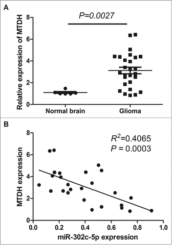 Figure 2. qRT-PCR analysis of MTDH expression in glioma tissues and normal brain tissues. (A) Level of MTDH mRNA is upregulated in glioma tissues compared with normal brain tissues (P = 0.0027). (B) Correlation between MTDH expression and miR-302c-3p expression in glioma tissues (P = 0.003, R2 = 0.4065).