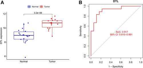 Figure 6 Validation of the diagnosis-related gene signature. (A) The expression of DTL in GSE53819. (B) ROC curves of DTL in GSE53819.