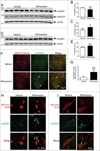 Figure 8. Rilmenidine treatment increases the burden of pathological and aggregated SOD1 in motor neurons of SOD1G93A mice. (A) Immunoblot analysis of soluble SOD1 protein levels in spinal cords of vehicle- and rilmenidine-treated SOD1G93A mice at end stage. Quantification of (B) human SOD1 (HsSOD1) and (C) misfolded SOD1 (misSOD1) protein levels normalized to vehicle-treated mice. (D) Immunoblot analysis of insoluble SOD1 protein levels in spinal cord pellet fractions of vehicle- and rilmenidine-treated SOD1G93A mice at end stage. (E) Quantification of HsSOD1 protein level in pellet fraction normalized to vehicle group. Data represent mean ± SD, n = 5 mice per group, **p<0.01 compared to vehicle-treated mice using an unpaired t-test. (F, H and I) Misfolded SOD1 immunohistochemical analysis of lumbar spinal cords of vehicle- and rilmenidine-treated SOD1G93A mice at 90 days of age. (F-H) In vehicle-treated mice, misfolded SOD1 shows diffuse staining in the cytoplasm of RBFOX3/NeuN-positive motor neurons (arrows). In rilmenidine-treated mice, SOD1 immunoreactivity is increased with accumulation of SOD1 into cytoplasmic aggregates in motor neurons. SOD1 accumulates into (H) Lewy body-like or (I) skein-like inclusions (arrows) in motor neurons. (G) Quantification of misfolded SOD1 aggregates in motor neurons. Data represent mean ± SD, n = 5 mice per group, **p<0.01 compared to vehicle-treated mice using an unpaired t-test.