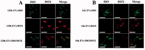 Figure 4. Cell internalization assay of 120k EVs (A) and 16k EVs (B) using confocal microscopy (Scale bar: 20 μm).
