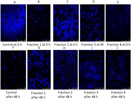 Figure 5. Morphological features of nuclei of A549 cells treated with four fractions of Syzygium aromaticum for 8 hrs.