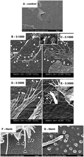 Figure 4. SEM image of (A) human bone marrow stem cells (HMSCs) with normal morphology on planar control materials; (B, C) filopodia interaction with the 3:1000 substrates (arrowheads) and inset on (C) shows filopodia curving around an island; (D, E) filopodia interaction with the 3:3000 substrates (arrowheads) and inset on (E) shows filopodia curving around an island; (F) filopodia interaction with the hemi substrates (arrowheads); and (G) filopodia curving around a hemisphere. Images reproduced with permission from [Citation47].