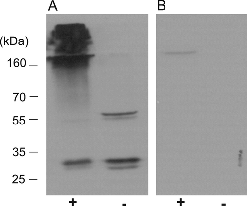 Figure 7.  The dimeric form of PEX19 is preferentially cross-linked to other proteins in vivo. Arabidopsis suspension cells were cross-linked in vivo with 1% formaldehyde. (A) The cell lysates, cross-linked (lane +), or not cross-linked (lane -), were examined by immunoblotting using antiserum raised against recombinant His6PEX19-1 at 1:10,000 dilution. (B) As panel A, but the antisera was incubated with rHis6PEX19 (10? µg) for 30 min at 37°C before immunodecoration of the blot.