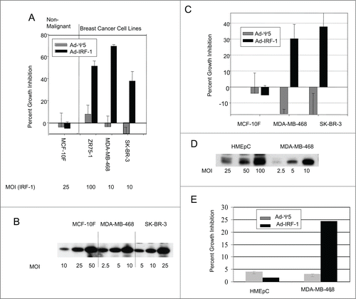 Figure 1. IRF-1 selectively inhibits human breast cancer growth. (A) The spontaneously immortalized nonmalignant human breast cell line, MCF-10F, and the human breast cancer cell lines ZR75-1, MDA-MB-468, and the SK-BR-3 were infected with the control Ad-Ψ5 or Ad-IRF-1, at multiplicities of infection (MOIs) 25, 100, 10, and 10 respectively. Cell growth inhibition was measured by MTT assays as described in Material and Methods. (B) Cells were infected at varying MOIs of Ad-IRF-1 and cells were harvested 24 h later. Cellular lysates were prepared for immunoblotting as described in Material and Methods. IRF-1 expression was evaluated by immunoblotting in the MCF-10F, MDA-MB-468, and the SK-BR-3 cell lines. (C) The MCF-10F, MDA-MB-468, and SK-BR-3 cell lines were subsequently infected at MOIs of 50, 10, and 25 respectively. MTT assays were conducted and cell growth inhibition was calculated as described in Material and Methods. (D) HMEpC and MDA-MB-468 cells were infected at varying MOIs and cells were harvested for immunoblotting as described in Material and Methods. (E) HMEpC and MDA-MB-468 cells were infected at MOIs of 50 and 10 respectively. Cell growth inhibition assays were conducted as described in Material and Methods. MTT was added 48 h post infection.