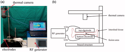 Figure 1. (a) Fusion system comprising a RF generator, fusion electrodes, a thermal camera, and a PC. (b) Schematic of the RF-induced intestinal tissue fusion system.