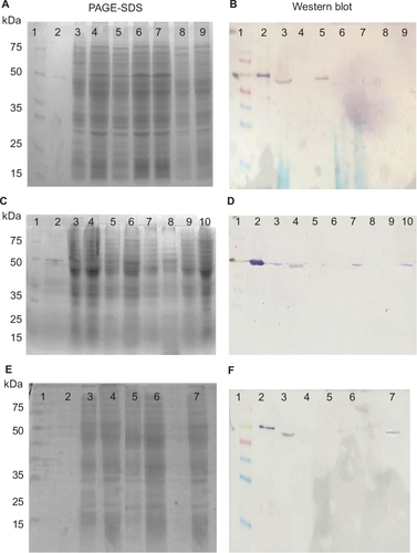 Figure 2 Detection of the OprD protein in 17 clinical blaIMP-carrying P. aeruginosa. (A, C, E) PAGE-SDS of extract total protein, (B, D, F) Western blot of extract total protein with polyclonal antisera anti-oprD.
