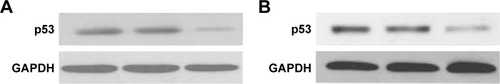 Figure 1 Expressions of p53 mRNA in (A) MUM-2B, C918, and (B) D78 cells as detected by RT-PCR.