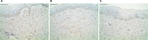 Figure 1 Procollagen 1 dermal histology.