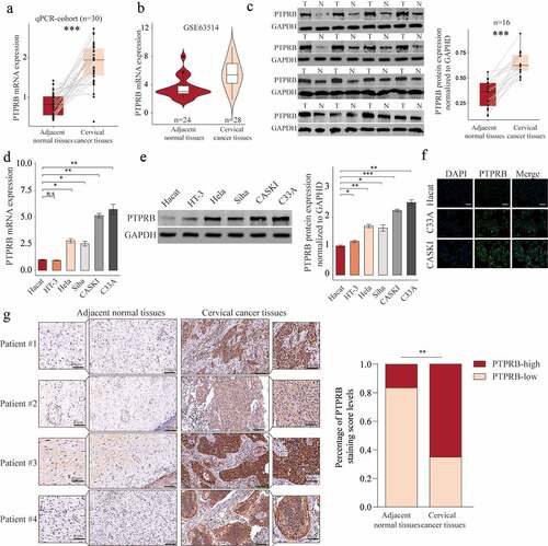 Figure 1. PTPRB expression was distinctly increased in CC. (a, b) PTPRB expressions in CC specimens compared with normal specimens in our cohort(a) and GSE63514 datasets(b). (c) Western blot assays were applied to evaluate the protein levels of PTPRB in 8 pairs of CC specimens and the adjacent non-tumor specimens. (d,e)The expression of PTPRB at mRNA and protein levels in five CC cells and Hacat cells. (f) Immunofluorescence determined the expressions of PTPRB in C33A and CASKI cells. (g) The levels of PTPRB in cancer and non-tumor samples from our patients were analyzed by IHC staining. The experiment was performed three times with three replications. *p < 0.05, **p < 0.01, ***p < 0.001