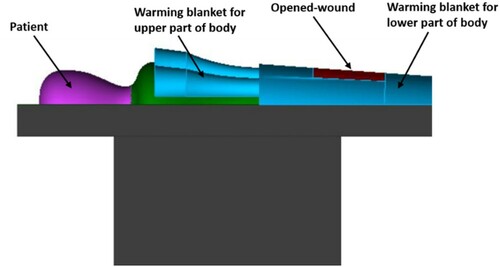 Figure 2. Isometric view of the patient covering with the warming blanket