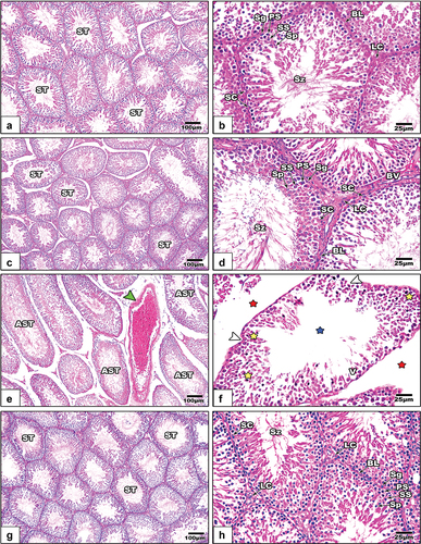 Figure 8. Histological images from the testicular sections among the different studied groups of rats (images a&b: control, images c&d: GE, images e&f: LPS, and images g&f LPS+GE). In images e&f, congested testicular capillary (green arrowhead), atrophied seminiferous tubules (AST), sperm lost (blue stars), degenerated spermatogenic stages (yellow stars), fragmented basal lamina (white arrow heads), and wide inter-tubular spaces (red stars). (stain: Hx&E, scale bar: 25).