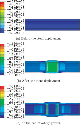 Figure 6. Von Mises stress (Pa) distribution at different stages.