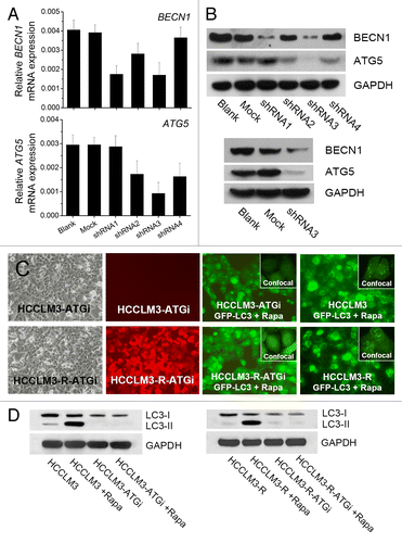 Figure 1. Generation of HCC cell lines with stable autophagy inhibition via lentivirus-mediated knockdown of BECN1 and ATG5. (A and B) Quantitative real-time PCR and western blot analysis of BECN1 and ATG5 knockdown. Effective shRNAs targeting BECN1 and ATG5 were selected and constructed into 2 lentiviral vectors. The knockdown efficiency of the cotransfection was analyzed by western blot. (C and D) HCC cell lines with stable autophagy inhibition (HCCLM3-ATGi and RFP-expressing HCCLM3-R-ATGi). GFP-LC3 transfection analysis and western blot analysis showed that rapamycin (Rapa) treatment did not induce autophagy in HCCLM3-ATGi or HCCLM3-R-ATGi cells while it induced intense autophagy in HCCLM3 and HCCLM3-R cells without autophagy inhibition.