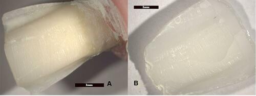Figure 4 Adhesive failure between the tooth and ceramic surfaces. No damage was detected in the tooth (A) or the porcelain (B).