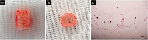 Figure 8. 3D-printed PCL tracheal scaffolds after 2 weeks of prior omental implantation. A. Anterior view. B. Superior view. C. H&E staining (x100), The asterisk indicates the cell ingrowth into the porous region L: lumen, S: scaffold.