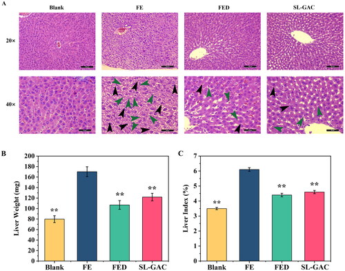Figure 7. Effects of SL-GAC on histopathological liver damage and physiological indexes of iron overload-induced mice. (A) Representative histologic images of liver tissues of mice obtained by HE staining. (B, C) The liver weight and liver index of mice in different groups were showed. Data represented as means ± SD (n > 6), *p < 0.05, **p < 0.01 versus FE group.