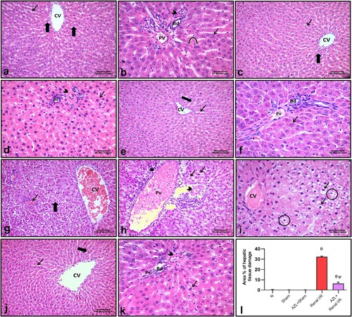 Figure 1. Photomicrographs of H&E-stained liver sections from sham and renal ischemic rats. NC group (a): showing normal liver architecture. Cords of hepatocytes (thick arrow) radiate from the central vein (CV) with blood sinusoids in between (thin arrow). (b): showing portal tract containing; a branch of the portal vein (Pv), bile duct (Bd) and hepatic artery (arrowhead). Hepatocytes (thin arrow) appear with acidophilic cytoplasm, a pale vesicular nucleus with a prominent nucleolus. A binucleated hepatocyte is noticed (curved arrow). Sham (c&d) and AZL + Sham (e&f) groups: displaying the same as the NC group. Renal I/R group (g): displaying apparent dilated and congested central vein (CV). Hepatocytes appear with highly vacuolated cytoplasm (thick arrow). Congested blood sinusoid (thin arrow) is noticed. (h): showing dilated and congested portal vein (CV) with mononuclear cell infiltration (star). Hepatocytes appear with highly vacuolated cytoplasm (thin arrow). (i): showing a congested central vein (CV). Most hepatocytes appear with vacuolated cytoplasm (thin arrow), and some appear swollen with small, dark and pyknotic nuclei. AZL + Renal I/R group (j): displaying restoration of normal histological structure of liver more or less as NC group. (k): showing portal tract containing a branch of the portal vein (Pv), bile duct (Bd) and hepatic artery (arrowhead). Cytoplasm of some hepatocytes is still vacuolated (thin arrow) [H&E; (a, c, e, g, h & j) magnification x200, scale bar = 100μm; (b, d, f, I & k) magnification x400, scale bar = 50μm]. (l): quantitative analysis of the area % of hepatic tissue damage in H&E-stained slides using a computer-assisted automated image analyzer. Six microscopic fields of H&E-stained slides were randomly chosen, analyzed and averaged for each slide. Each bar represents the mean ± SD of four rats per group. ϴp < 0.0001 vs. NC and sham control groups; ΨP < 0.001 vs. Renal I/R group.