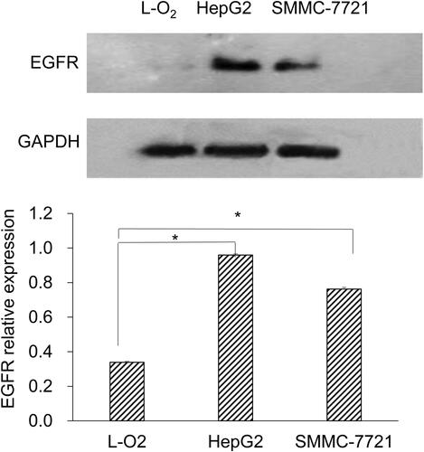Figure 2. Expression of EGFR protein in L-O2, HepG2 and SMMC-7721 cells. Western blot was performed. Representative and quantitative results are shown. *p < 0.05.