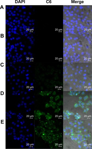 Figure 7 Confocal laser scanning microscopy of cell uptake of HaCaT cell after 4 hours of administration of (A) DMEM; (B) C6 aqueous suspension; (C) C6–NIC complex suspension; (D) C6–HA–Chol–NP suspension; and (E) C6–HA–Chol–NPs–NIC suspension.Notes: The concentration of C6 in each formulation was 10 μg/mL. Cells were stained for nuclei (in blue) and C6 (in green). Scale bar: 20 μm. Magnification ×400.Abbreviations: C6, coumarin 6; C6–HA–Chol–NP, coumarin 6-loaded hyaluronic acid–cholesterol nanoparticle; C6–HA–Chol–NPs–NIC, coumarin 6-loaded hyaluronic acid–cholesterol nanoparticles containing nicotinamide; C6–NIC complex, coumarin 6–nicotinamide complex; DAPI, 4′,6-diamidino-2-phenylindole; DMEM, Dulbecco’s Modified Eagle’s Medium; h, hours; HaCaT, human keratinocytes.