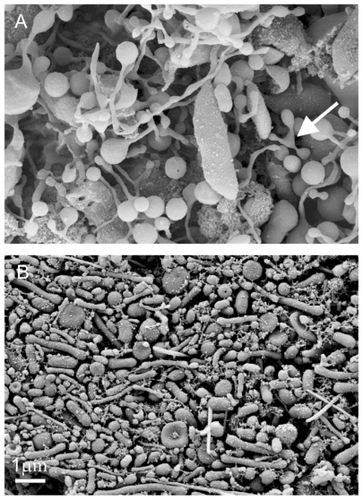 Figure 4 Deformation of cell-derived material obtained by isolation procedure. Deformed cells from the blood of a healthy mare (aged five years) exhibit protrusions connected by thin necks, which were torn eventually to yield membrane-enclosed cell fragments (A). Close to the tube wall, the shear forces in the centrifuge are high and therefore the cell fragments in the isolate from the blood of a healthy human donor (male, 28 years) are elongated and exhibit preferential orientation (B). The images were taken using a LEO Gemini 1530 (LEO, Oberkochen, Germany) scanning electron microscope by applying 8 kV at Åbo Akademi University, Åbo/Turku, Finland.