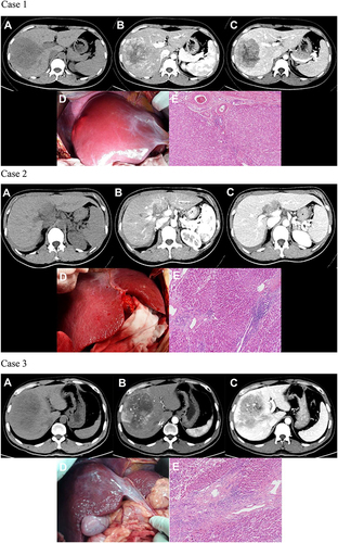 Figure 1 Continued.