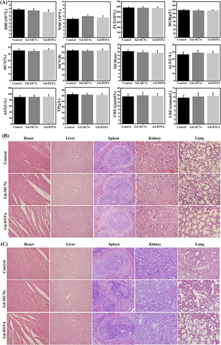 Figure 5 In vivo toxicity test. (A) Mouse serum blood routine and biochemistry analysis after treatment at 72 h; histological images of heart, liver, spleen, kidney and lung of mice after treatment at 72 h (B) and 12 weeks (C).