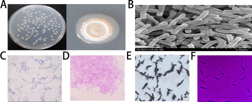 Figure 3. Morphological characteristics of ZW-10.Colony morphology (A); scanning electron microscope observation (B); gram staining (C); spore staining (D); flagella staining (E); and decidua staining (F).Note: Magnification; 400-fold (C and D) and 1000-fold (E and F)
